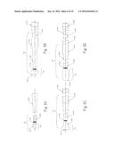 Methods and Devices for Removal of Thromboembolic Material diagram and image