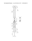 BONE GRAFT MATERIALS, DEVICES AND METHODS OF USE diagram and image