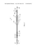 System And Method For Navigated Drill Guide diagram and image