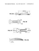 SCLERAL PROSTHESIS FOR TREATING PRESBYOPIA AND OTHER EYE DISORDERS AND     RELATED DEVICES AND METHODS diagram and image