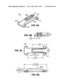 SCLERAL PROSTHESIS FOR TREATING PRESBYOPIA AND OTHER EYE DISORDERS AND     RELATED DEVICES AND METHODS diagram and image