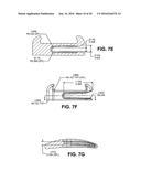 SCLERAL PROSTHESIS FOR TREATING PRESBYOPIA AND OTHER EYE DISORDERS AND     RELATED DEVICES AND METHODS diagram and image