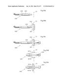 DEVICE FOR TREATING OBESITY diagram and image