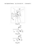 Negative Pressure Oral Apparatus diagram and image