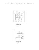 Negative Pressure Oral Apparatus diagram and image