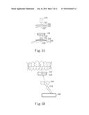 Negative Pressure Oral Apparatus diagram and image