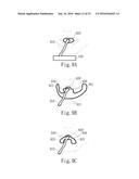 Negative Pressure Oral Apparatus diagram and image