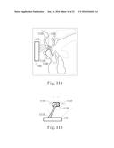 Negative Pressure Oral Apparatus diagram and image