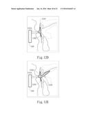 Negative Pressure Oral Apparatus diagram and image