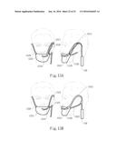 Negative Pressure Oral Apparatus diagram and image