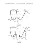 Negative Pressure Oral Apparatus diagram and image