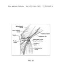 Methods and Devices for Pain Management diagram and image
