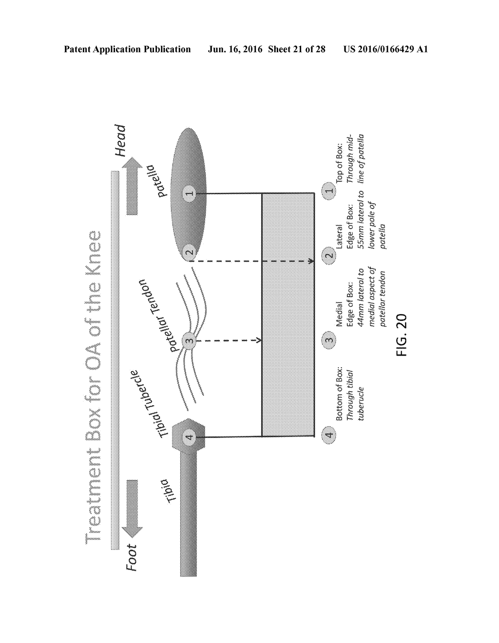 Methods and Devices for Pain Management - diagram, schematic, and image 22