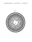 Devices and Methods for Creating a Predictable Capsulorhexis of Specific     Diameter diagram and image