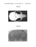 Material for Treatment of Cerebral Infarction diagram and image