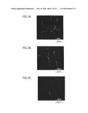 Material for Treatment of Cerebral Infarction diagram and image