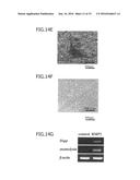 Material for Treatment of Cerebral Infarction diagram and image