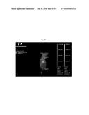 Nanoparticle Diagnostic and Methods for Treating Disease diagram and image