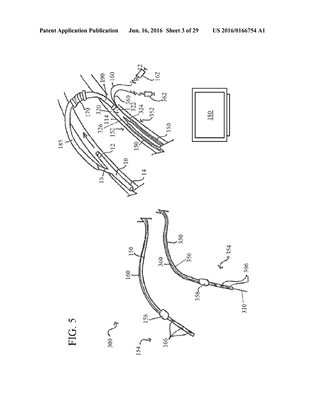 UNITARY BODY SYSTEMS AND DEVICES AND METHODS TO USE THE SAME FOR     RETROPERFUSION - diagram, schematic, and image 04