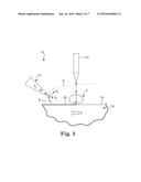 LASER GENERATED SURFACE FINISHES FOR IMPLANTABLE MEDICAL DEVICES AND     ELECTRODES diagram and image