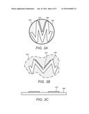 PERCUTANEOUSLY IMPLANTABLE PADDLE-TYPE LEAD AND METHODS AND DEVICES FOR     DEPLOYMENT diagram and image