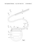 ELECTRICAL STIMULATION SYSTEM WITH OPERATING ROOM CABLE/WOUND BANDAGE AND     METHODS OF MAKING AND USING diagram and image