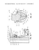 Exercising Apparatus diagram and image