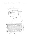 MOULD ARRANGEMENT AND METHOD FOR COMPRESSION MOULDING FIBER REINFORCED     PREFORMS diagram and image