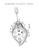 CHALK LINE DEVICE diagram and image