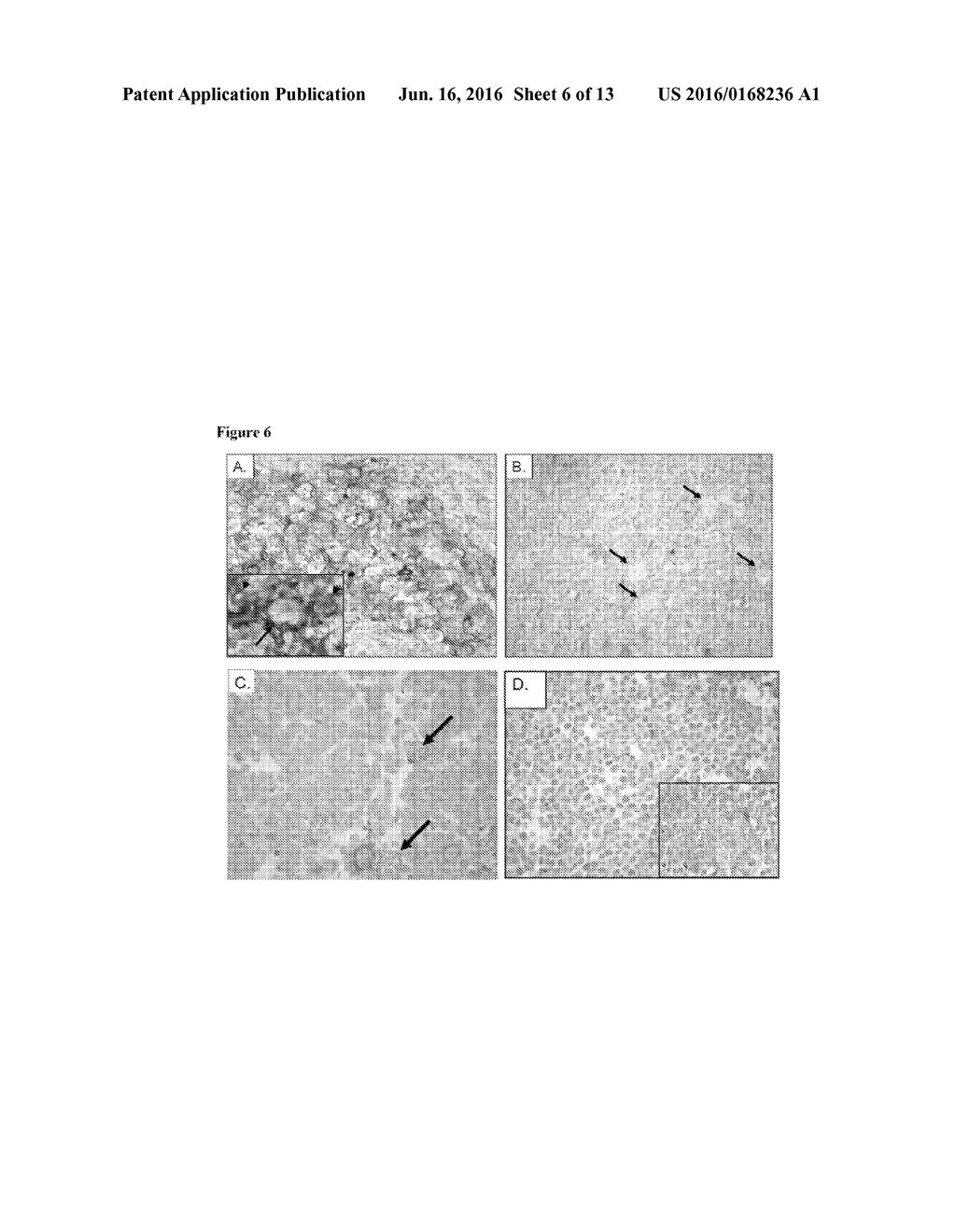 ANTI-GALECTIN-1 MONOCLONAL ANTIBODIES AND FRAGMENTS THEREOF - diagram, schematic, and image 07