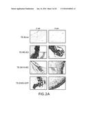 TISSUE ENGINEERED MODELS OF CANCERS diagram and image