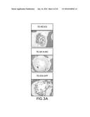 TISSUE ENGINEERED MODELS OF CANCERS diagram and image