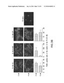 TISSUE ENGINEERED MODELS OF CANCERS diagram and image