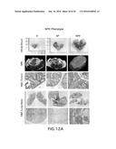 TISSUE ENGINEERED MODELS OF CANCERS diagram and image