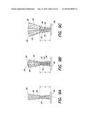 METHOD OF TREATING SURFACES diagram and image