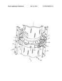 SUPPORTING TOOL FOR SUPPORTING CYLINDRICAL PARTS, LIKE LANDING GEAR RODS     AND CYLINDERS diagram and image