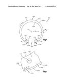 Anti-Rotational Circlip diagram and image