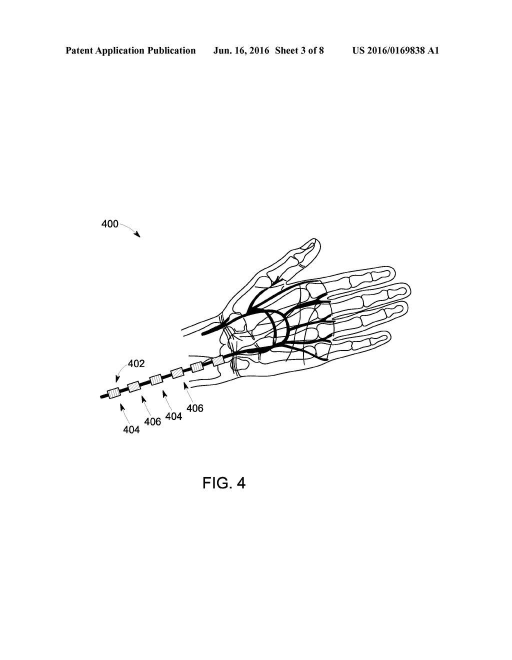 SYSTEMS AND METHODS FOR IMPROVED PHYSIOLOGICAL MONITORING - diagram, schematic, and image 04