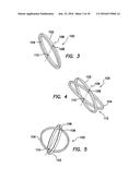 Wound Retractor diagram and image