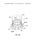 Wound Retractor diagram and image