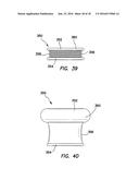 Wound Retractor diagram and image