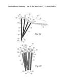 Bone Plate diagram and image