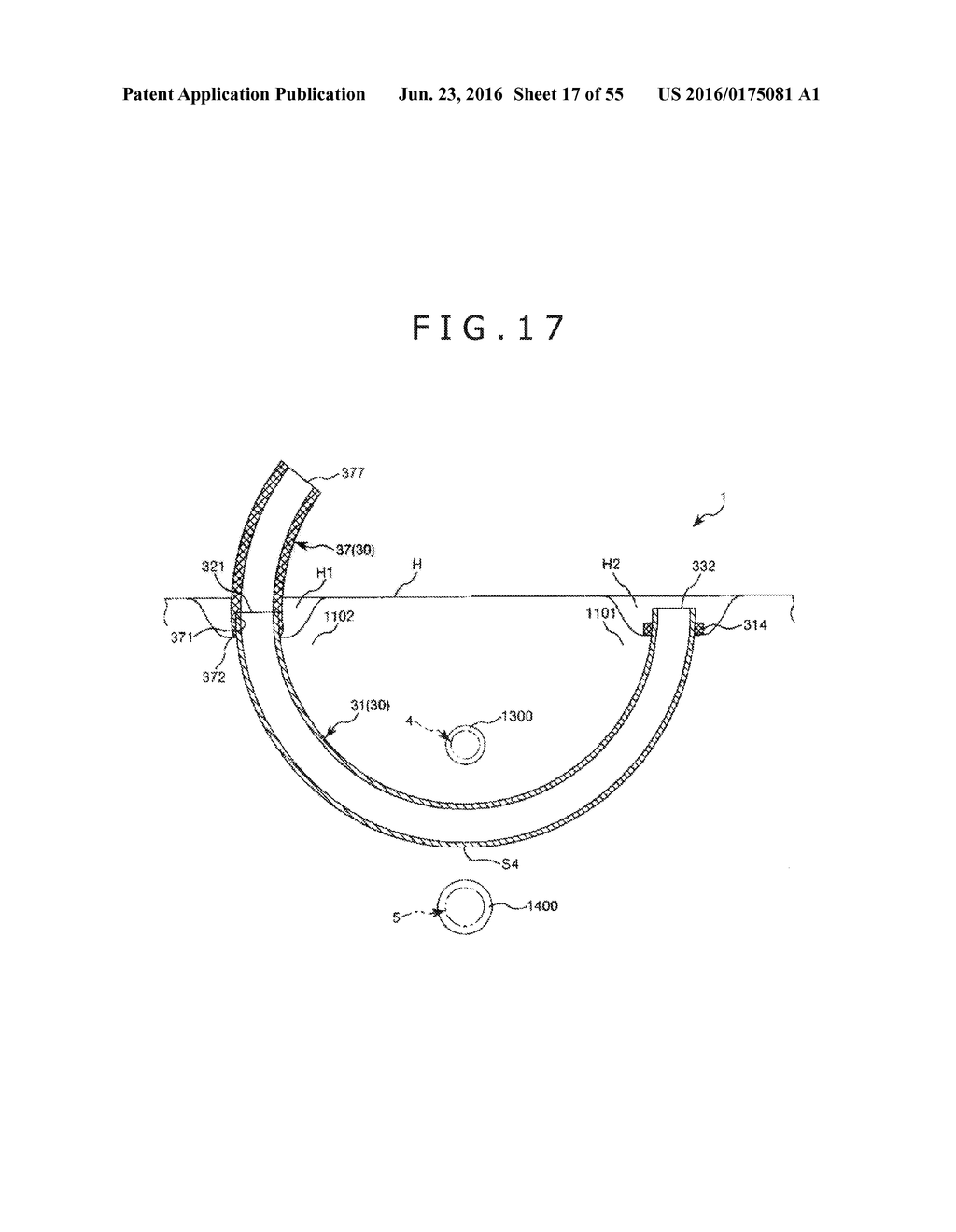 MEDICAL TUBE, MEDICAL DEVICE SET, AND METHOD OF PLACING IMPLANT INDWELLING - diagram, schematic, and image 18