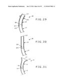 MEDICAL TUBE, MEDICAL DEVICE SET, AND METHOD OF PLACING IMPLANT INDWELLING diagram and image