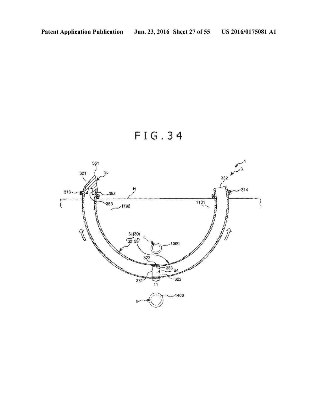 MEDICAL TUBE, MEDICAL DEVICE SET, AND METHOD OF PLACING IMPLANT INDWELLING - diagram, schematic, and image 28