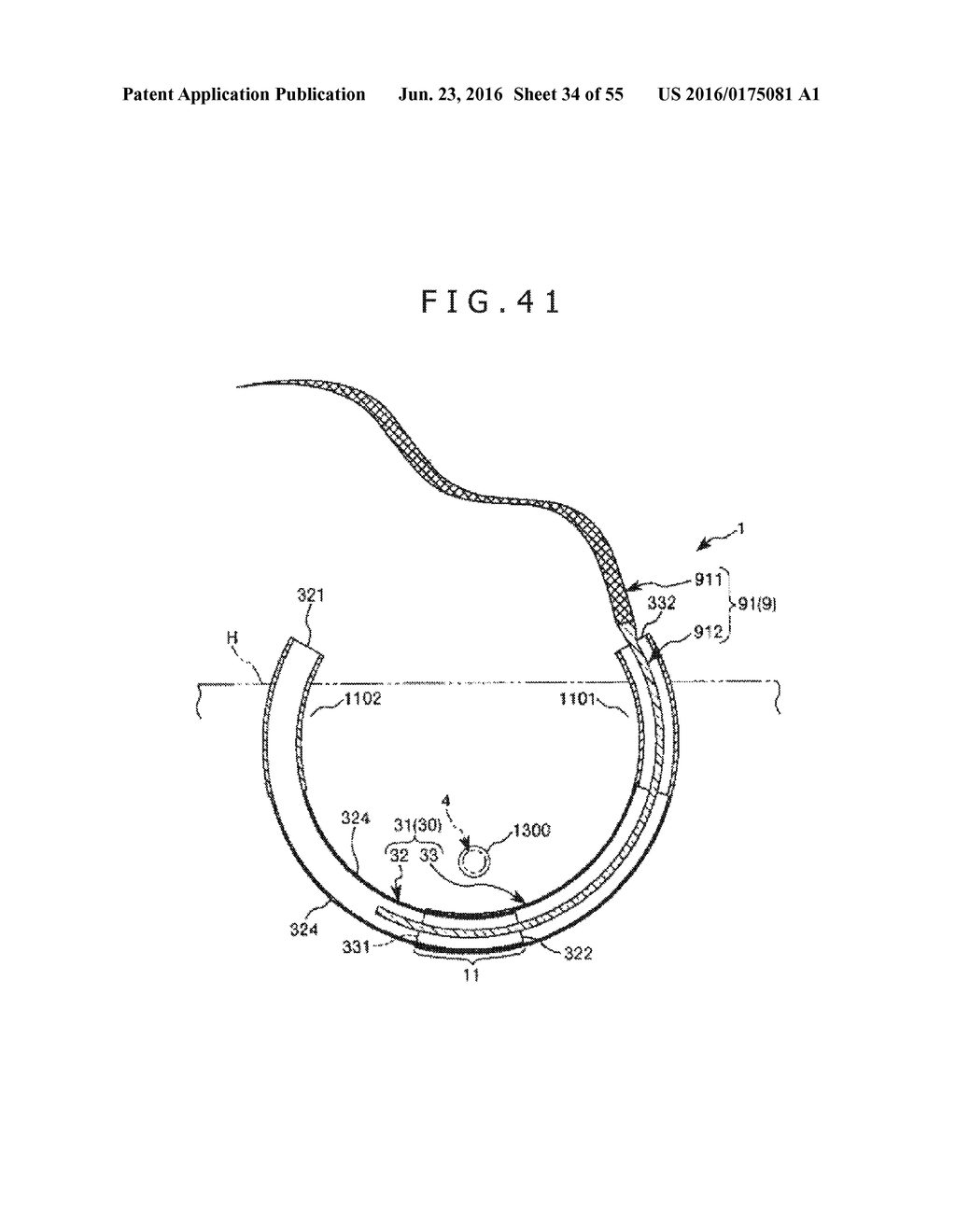 MEDICAL TUBE, MEDICAL DEVICE SET, AND METHOD OF PLACING IMPLANT INDWELLING - diagram, schematic, and image 35