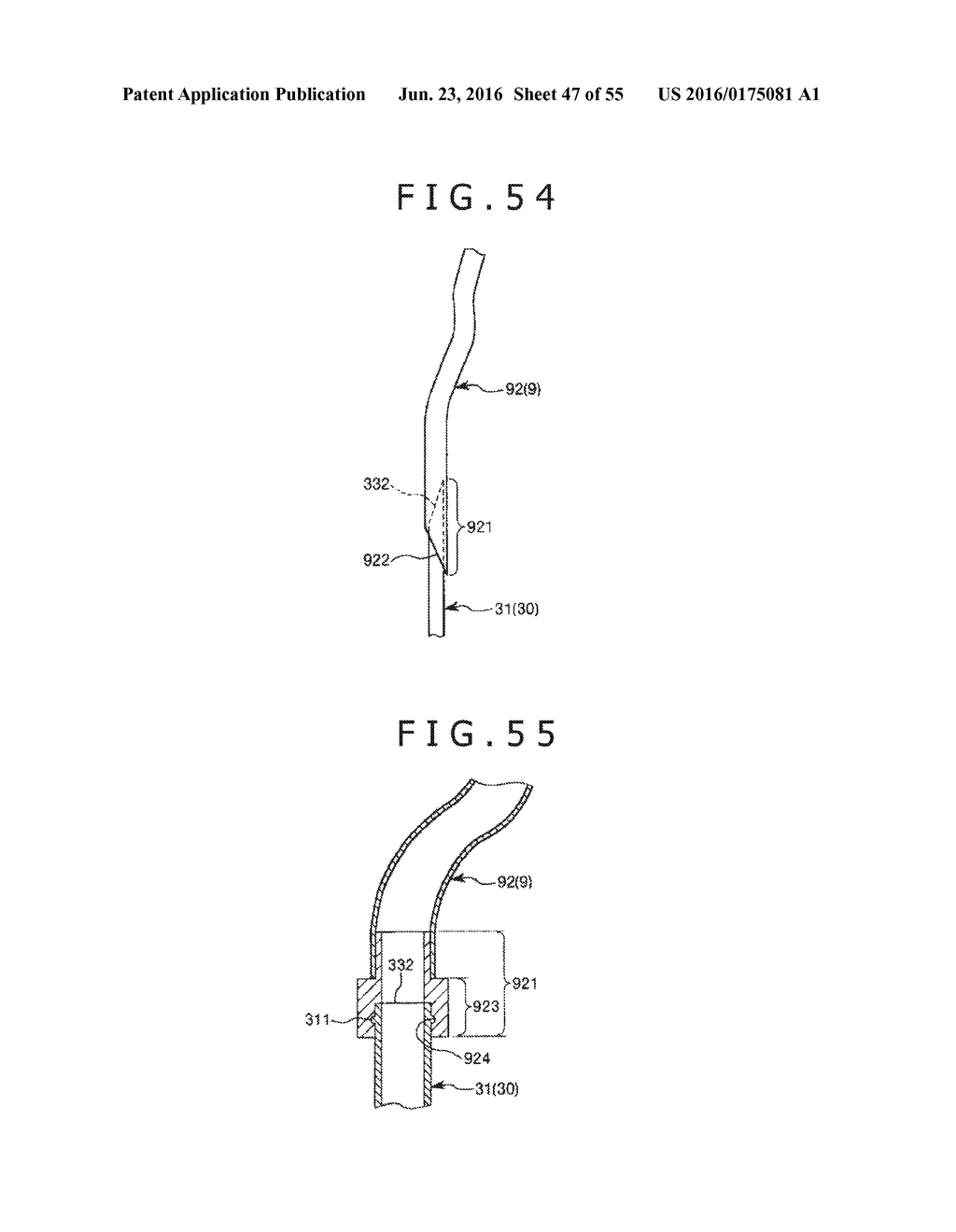 MEDICAL TUBE, MEDICAL DEVICE SET, AND METHOD OF PLACING IMPLANT INDWELLING - diagram, schematic, and image 48