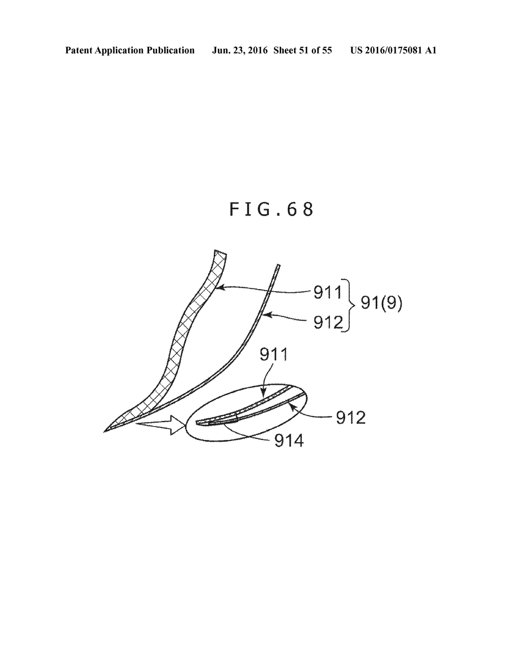 MEDICAL TUBE, MEDICAL DEVICE SET, AND METHOD OF PLACING IMPLANT INDWELLING - diagram, schematic, and image 52