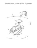 LEADLESS CARDIAC STIMULATION SYSTEMS diagram and image