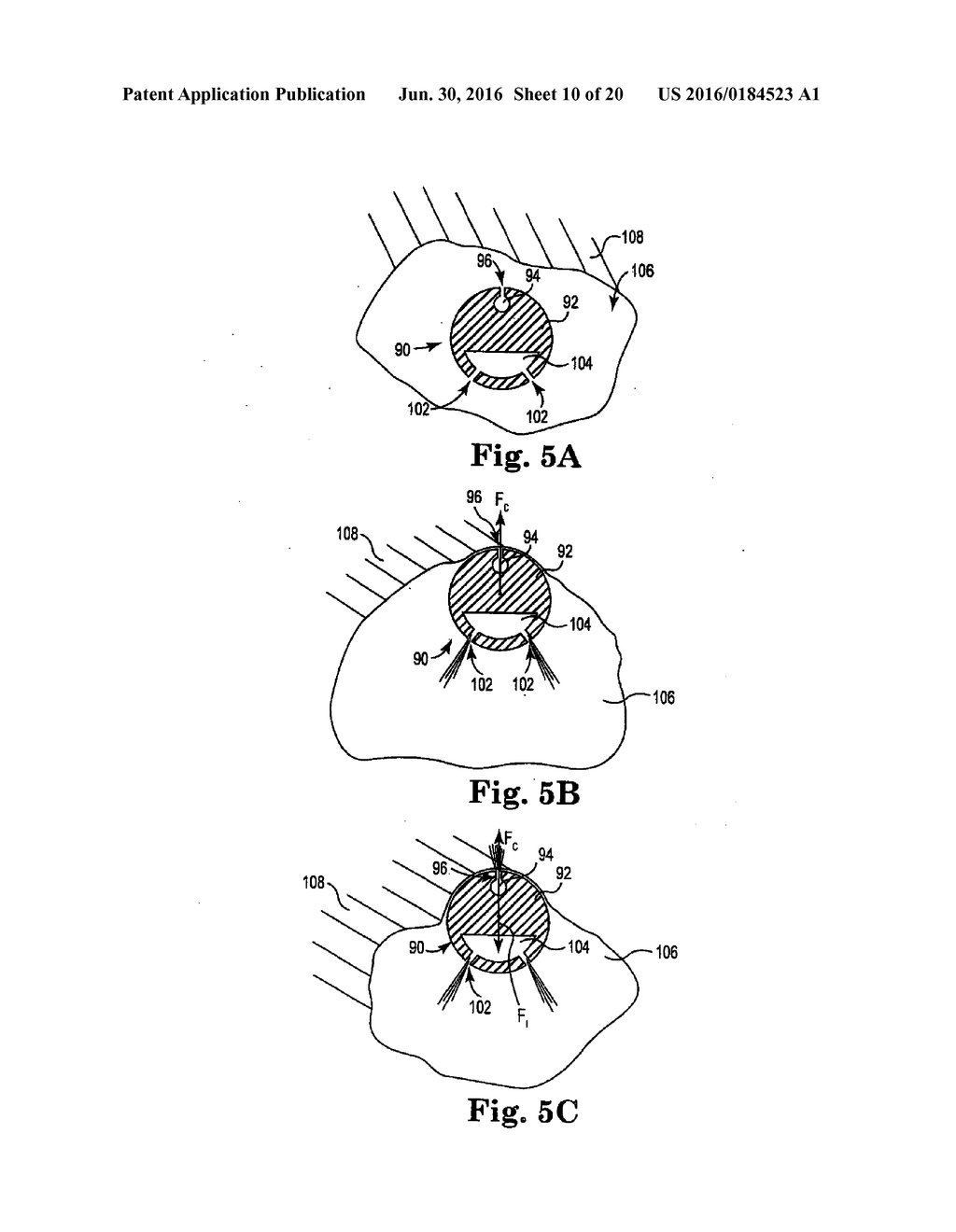 DEVICES, SYSTEMS, AND RELATED METHODS FOR DELIVERY OF FLUID TO TISSUE - diagram, schematic, and image 11